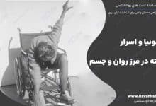 کاتاتونیا و اسرار نهفته در مرز روان و جسم