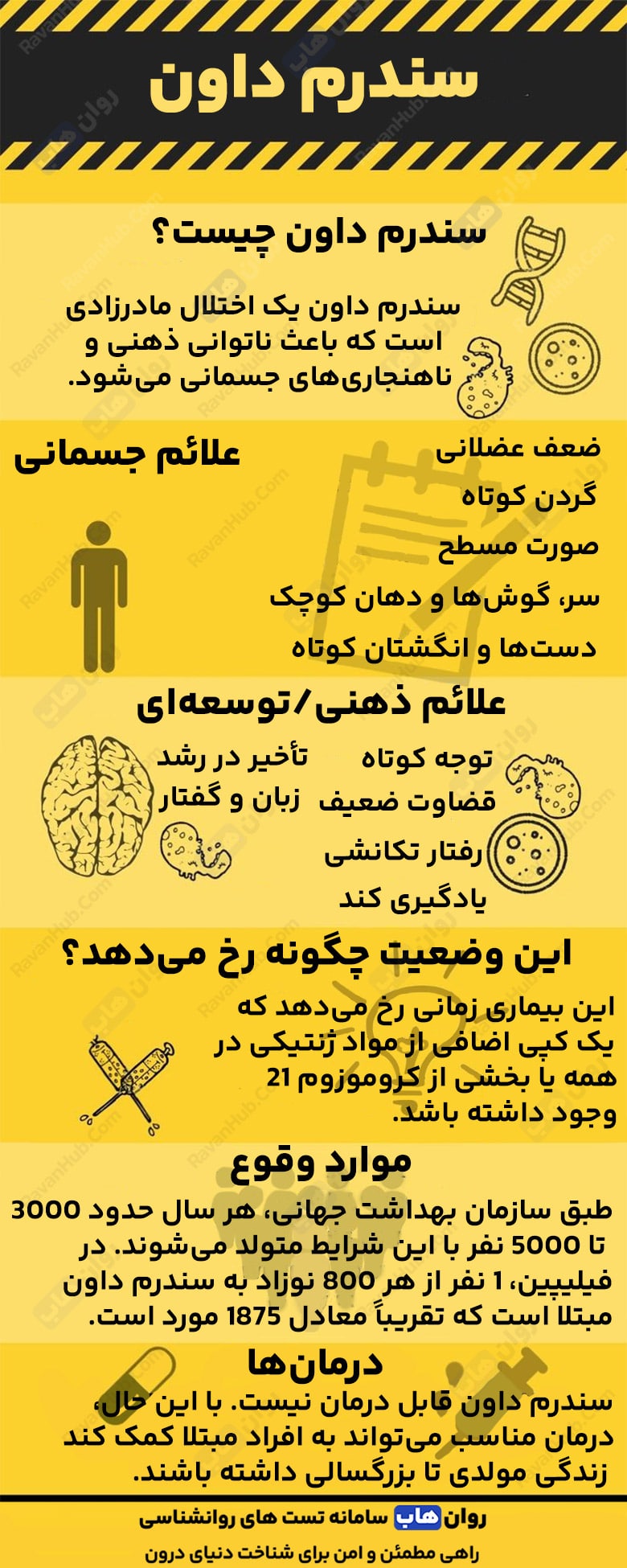 کاوشی به بیماری سندرم داون تریزومی 21