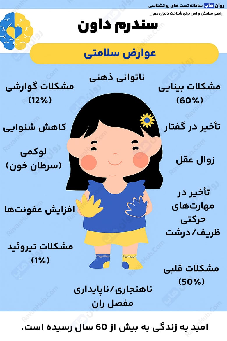 کاوشی به بیماری سندرم داون تریزومی 21