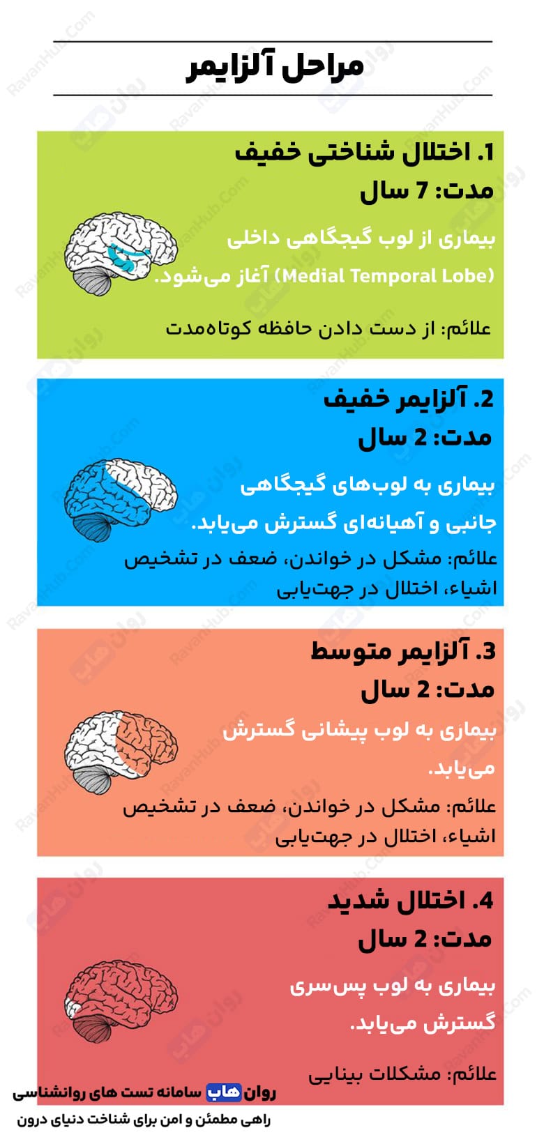 بررسی علائم و نشانه های بیماری آلزایمر