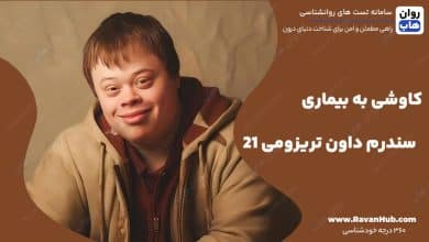 کاوشی به بیماری سندرم داون تریزومی 21
